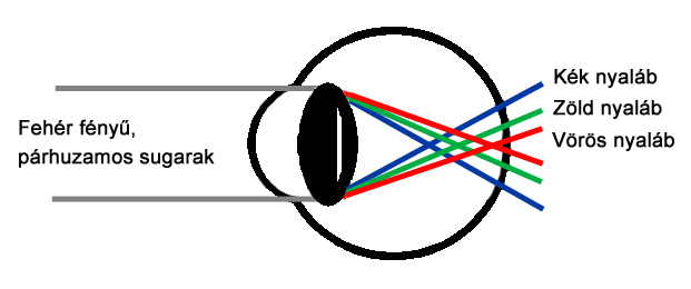 Kromatikus aberráció a szemben
